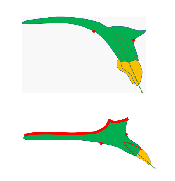 上顎の前方部の骨が後方にあり骨体自体がかなり狭小になっている図