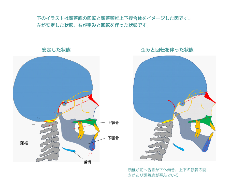 頭蓋底の回転と頭蓋頸椎上下複合体をイメージした図